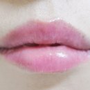 이브스 테라피