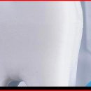 서울강남플란트치과의원 이미지