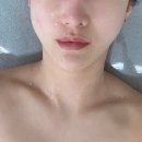 고잔동윤곽관리 맛집 | 통증없이 효과가 확실한 하이푸 윤곽관리 더맑은에스테틱 후기