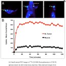 Re:Re:Metabolic Imaging of Glutamine in Cancer - 글루타민 PET 검사법 이미지