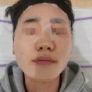 행복한피부전문관리샵 | [원주 피부관리샵] 원주 여드름 압출 케어 원주 여드름관리 세레누 내돈내산 2회차