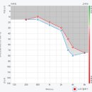굿모닝보청기 강서가양센터 이미지