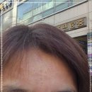 아가파의원 | 김포 아가파의원 비립종 제거 리얼후기-대기부터 비용까지