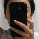빨간여우 - 김해시 인제로200번길 11 | 눈꼬리 리프팅/여우눈 성형/여우눈 리프팅 후기