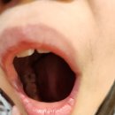 대전 둔산동 청담수치과 울딸 첫 교정검진 받고온 리얼후기 (+내돈내산)