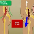 골반교정 필라테스 이미지