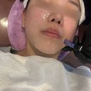 월곡동10 | 광주 월곡동 모공관리 esv10 후기 “월곡동 리즈”