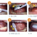 손강하치과의원 네이버블로그