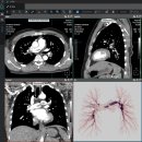 코어소프트 이미지