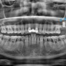 아이엠플란트치과의원 이미지