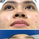 성형산업 이미지