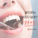고운니치과의원 네이버블로그