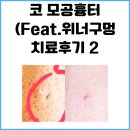 [내돈내산]코 모공흉터 이어짐 + 위너구멍 치료후기 2