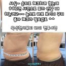 (주)알테크놀리지 | 1회로 줄자가 필요 없는 변화? 수원 알테온 하이퍼노바의 '심부 집중 컨투어링'의 비밀 [왁싱천사뷰티후기]