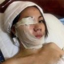 염산오토바이