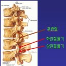 근육학(MPS) - 근육의 단축과 관계 있는 임상증후군 이미지