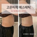 부산 웨딩 관리 [고은미학 에스테틱] 기장 뱃살 다이어트 후기