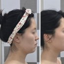 웰발란스메디칼 | 부산대에스테틱 피부관리 전문 뷰티인스킨 입체윤곽관리 후기