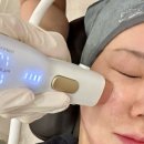 드라마틱 클래식 | 부산덴서티 배우 한가인 추천 리프팅 서면 덴서티 클래식 팁 후기