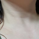 브랑떼이지에프코스메틱 | 브랑떼화장품 EGF프리미엄재생크림 기적같은 놀라운 효과 14일의 변화를 기록하다
