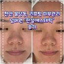 한설에스테틱 | 천안 불당동, 리프팅 피부관리 넘버원 <한설에스테틱> 후기