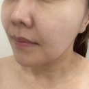 미사랑에스테틱피부 | 미사피부샵 랑오르 에스테틱 수분관리 후기