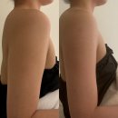 범계빌딩 개방화장실 | 범계 에스테틱 웨딩관리로 유명한 메종드마인 안양범계점 팔 집중 슬리밍케어 솔직후기