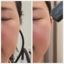 대화기기(주) | 옥정두피관리 뷰티온 피부&amp;헤드스파 온프팅 헤드스파 후기