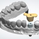 이레치과기공소 이미지