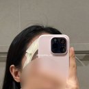 가까운성모약국 | [라섹 후기] 밝은성모안과 강남, 투데이라섹 후기 (내돈내산)