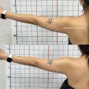 안산메디칼 | [안산] 내돈내산 예신 에스테틱/팔뚝관리 2회차 후기/극초단파 미레브로 팔라인 변화 '메리미뷰티'