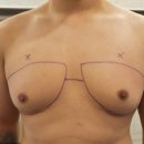서울수비뇨의학과의원 이미지