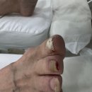 레푸스앤두두뷰티 | 불편하고 아팠던 발톱을 전문적으로 관리를 할 수 있는 곳, '레푸스 앤 두두 뷰티'