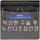 대명렌즈광학 | 60대 익상편(군날개) 수술 원시 노안의 누진다초점렌즈 안경 제작 후기