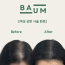 바움SMP