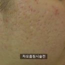 리유한의원 강남본점에서 받은 차오름침 가격 효과 후기 공유해요