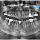 소망플란트치과의원 이미지