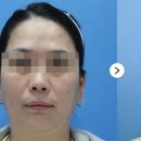 케이톡스의원인천 네이버블로그