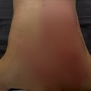 베이시스 | 부천 경락 체형관리 베이시스 방문 후기 예신한테 인기 많은곳