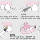 뉴플란트치과의원 이미지