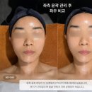 뷰티하우스K | 청담에스테틱 추천｜연예인 피부관리 뷰티블르바드 물광수분관리 후기