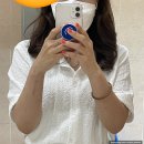 박종철한의원 | [공지] 척골충돌증후군과 결절종 tfcc 병원들 비교 / 척골단축수술후기(2)+스테로이드 주사 부작용