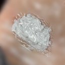 DH메드 | 신사역 성형외과 수술후 흉터관리 2회차 신상성형외과에서 레이저+흉처주사