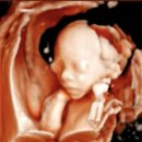 용산구종합행정타운기타 | 용산구 보건소 임산부 지원 프로그램ㅣ쿼드검사 철분제 수령 후기