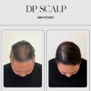 소로3-71(혁신도시) | 음성/금왕 탈모인들이 청주까지 나가는 시간+돈 값 아껴주는 현실 대안