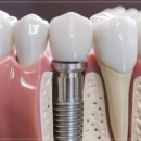 복치과의원 이미지