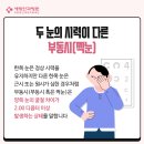 새빛안경콘택트 이미지