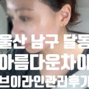 아름다운 차이 - 남구 | 울산 남구 달동 주차가능한 아름다운차이 얼굴바로 브이라인즉각된 후기