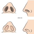 일퍼센트성형외과의원 네이버블로그