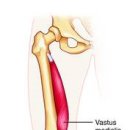 vastus medialis(내측광근) 이미지